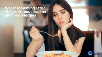 Was it something I ate? The truth about eczema and food allergies