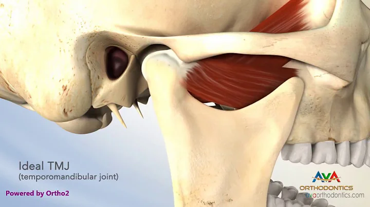 TMJ Disorder or TMD - Clicking and Closed Lock - DayDayNews