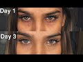 Get Rid Of Dark Circles in 3 Days? || Does it really work?