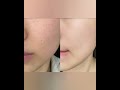 skincare routine #skincare #koreanskincare #healthyskin #glowingskintips