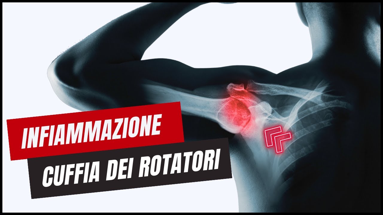 Burn Machine - Allenatore Avambraccio E Spalla Regolabile 8-18LB | Attrezzo Fitness Rotante Per Casa E Palestra | Tonificazione Braccia E Petto