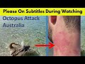 Shorts  geologist lance karlson beaten by octopus on beach  australia  the angriest octopus  