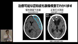 JapanCancerForum 2019「認知症とがん」山口 潔 先生