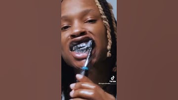 Thumbnail of King von no flaws