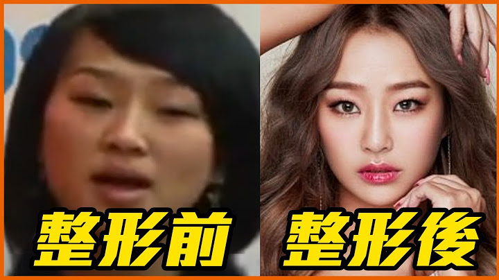 16位霸氣承認整形的韓星！ 《社內相親》薛仁雅鼻子以前超大 - 天天要聞