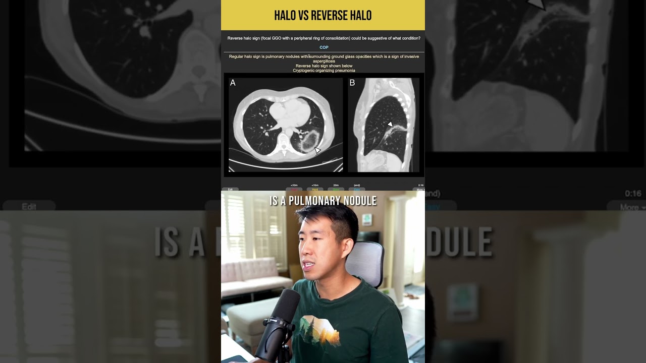Halo vs Reverse Halo Sign on CT Imaging