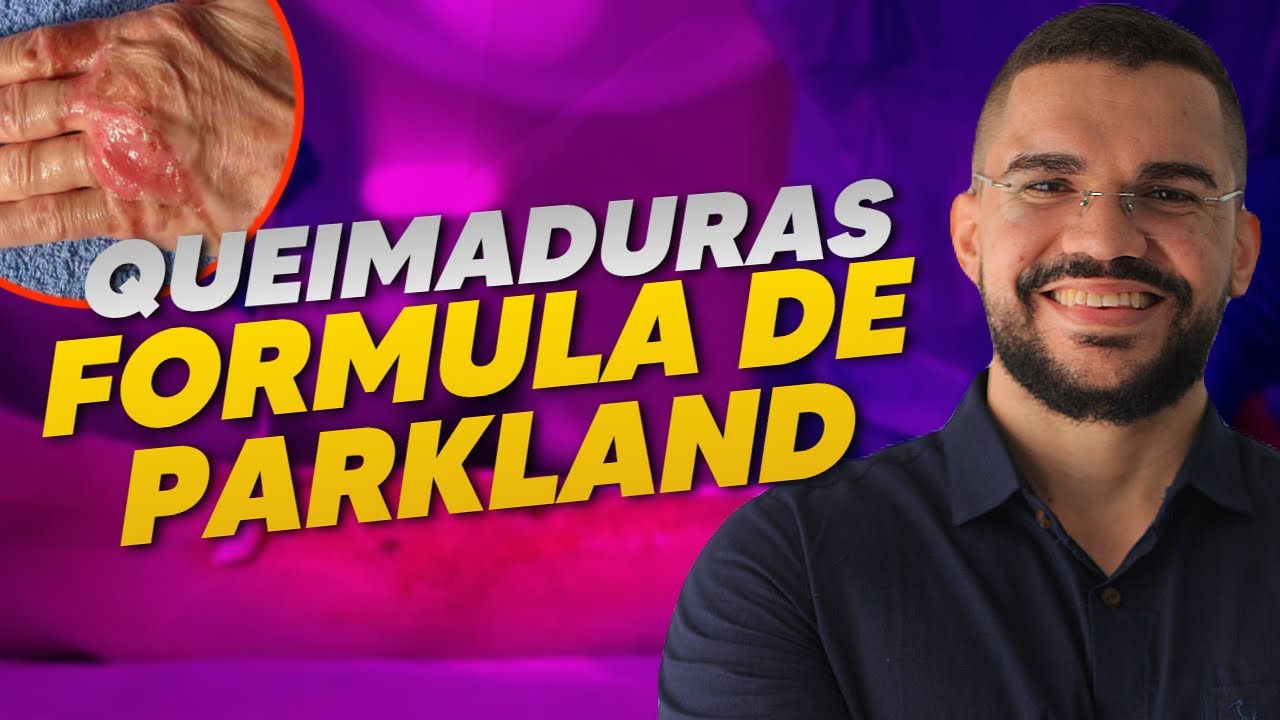queimaduras-formula-de-parkland-como-calcular-youtube