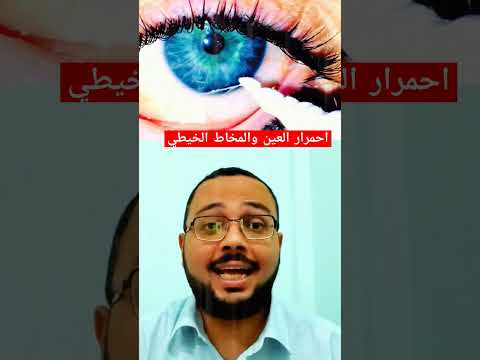 احمرار العين و وجود خيوط فيها لما عينيك توجعك