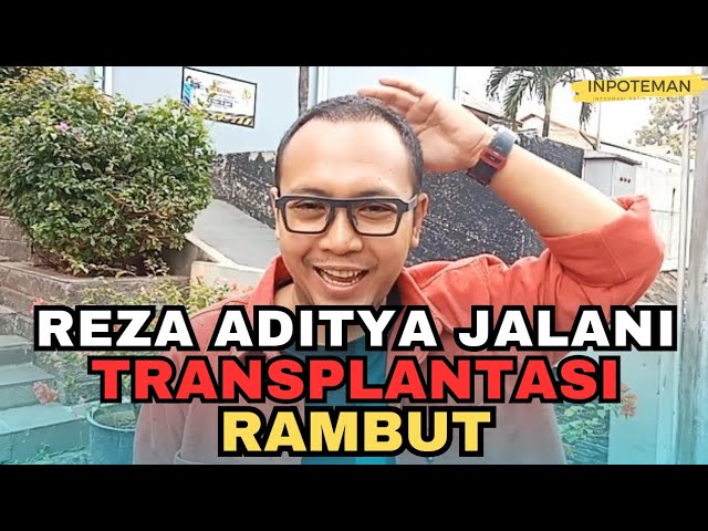 Presenter Reza Aditya Transplantasi Rambut Usai Alami Kebotakan | INPOTEMAN class=