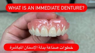What is an immediate denture? ما هو طقم الأسنان الفوري؟