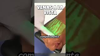 Venas A La Vista Íamedica Édico