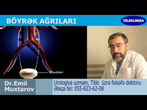 Böyrek ağrılarının 3 əsas elameti. Dr.Emil Muxtarov. Uroloji uzmanı.