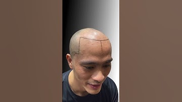 Trend biến hình của tôi #love #smp #vnscalp #xămtóc