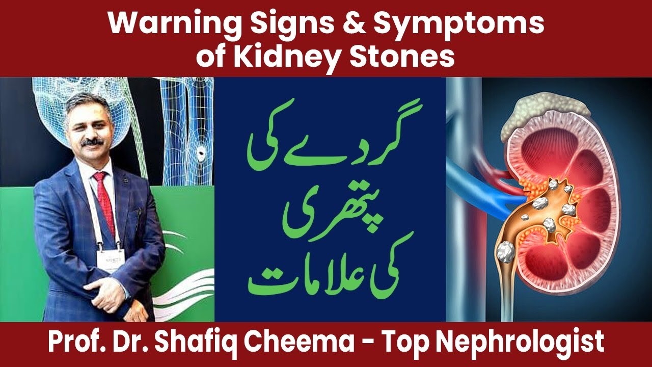 Warning Signs & Symptoms of Kidney Stones Treatment of Stones 