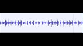 Heart Sounds - Quiet Machinery Murmur With Some Electrical Disturbance Clicks screenshot 5