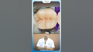 Sâu Kẽ Răng Phá Hủy Răng Bạn Như Thế Nào | Nha Khoa Minh Châu