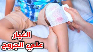 تعلم الطريقة الصحيحة للغيار علي الجروح والغرز ومكان العملية_wound dressing and wound care