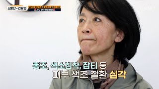 늦깎이 피부 지킴이가 되었지만 건강 상태가 심각한 주인공😰 TV CHOSUN 240504 방송