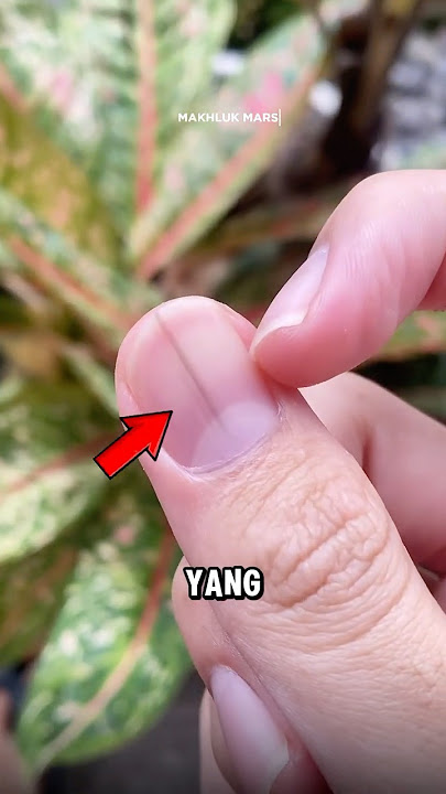 Jangan biarkan garis hitam ini berada di kukumu‼️😱