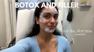 Botox and Filler for the first time! Part 1 | Day 1 &amp; 2 *no needles*