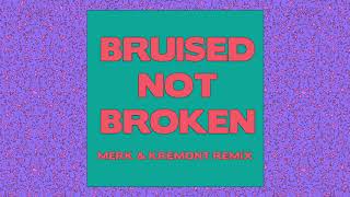 Video thumbnail of "Matoma - Bruised Not Broken (feat. MNEK & Kiana Ledé) [Merk & Kremont Remix] {Official Audio}"