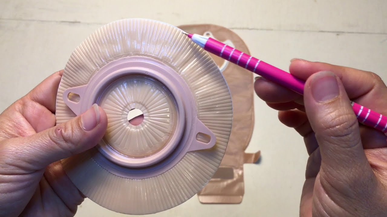 มาดูให้หายสงสัย..ถุงถ่ายอุจจาระติดยี่ห้อโคโลพลาส (Coloplast) แบบ 2 ชิ้นนั้นมีหน้าตาเป็นอย่างไร