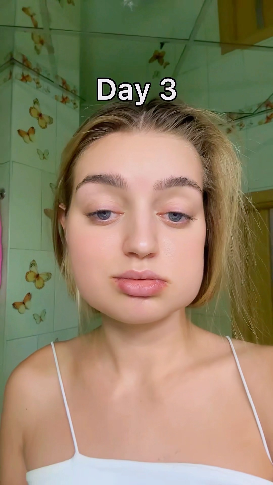 My real Christmas?❤️‍?? Rate my facial tumor 1-10??