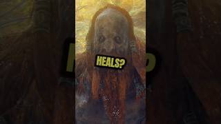 Why Do These Gods Leave Scars Forever?