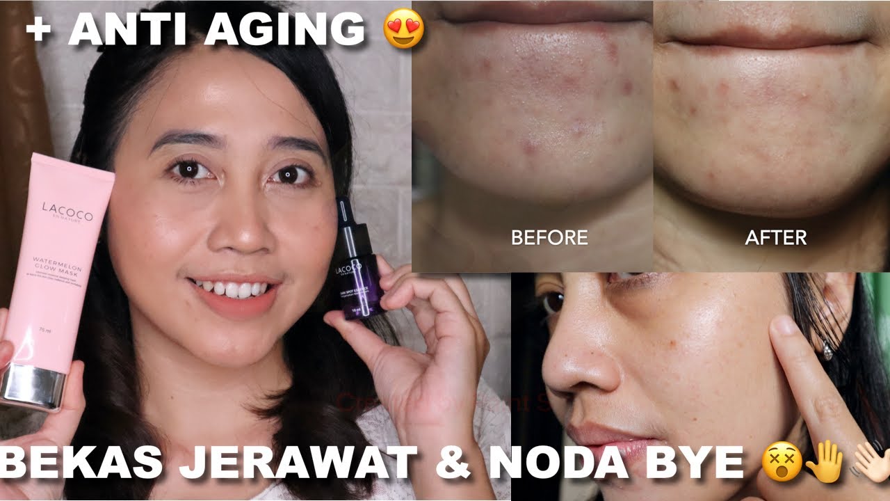 REVIEW LACOCO DARK SPOT ESSENCE WATERMELON GLOW MASK Skincare review-lacoco-dark-spot-essence-watermelon-glow-mask-skincare