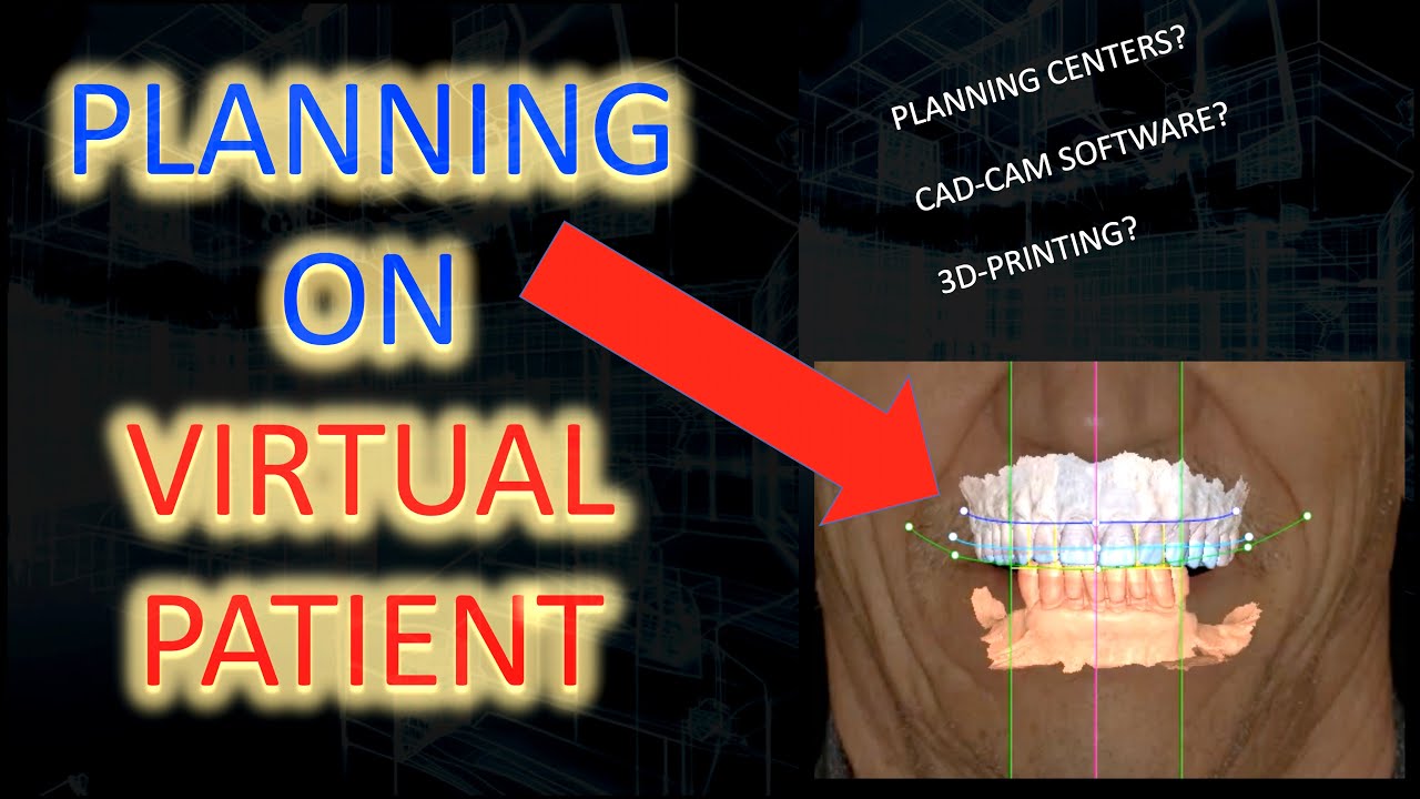 ENSURING Dental Esthetics Results : The Virtual Patient Workflow - YouTube
