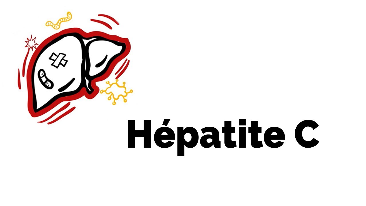 Vidéo sur l'hépatite C - Société gastro-intestinale | www ...