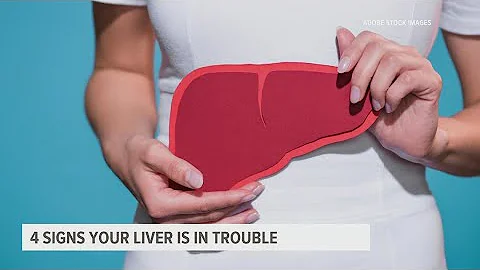 4 warning signs your liver is unhappy | Health Smart