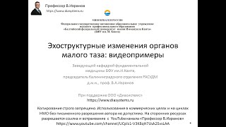 УЗИ органов малого таза у женщин: обзор видеопримеров