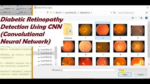 Diabetic Retinopathy Detection CNN Convolutional Neural Network Matlab Project Source Code