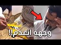ودع وجهه بسبب مقلب تافه من اصحابه 