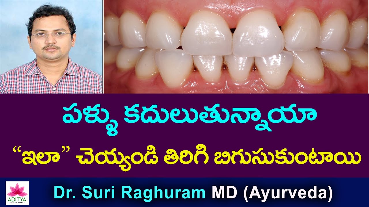 గంటల్లో ఫలితం చూపే ఆయుర్వేద కషాయం | కదిలే పళ్ళు వెంటనే బిగుసుకోవాలంటే 