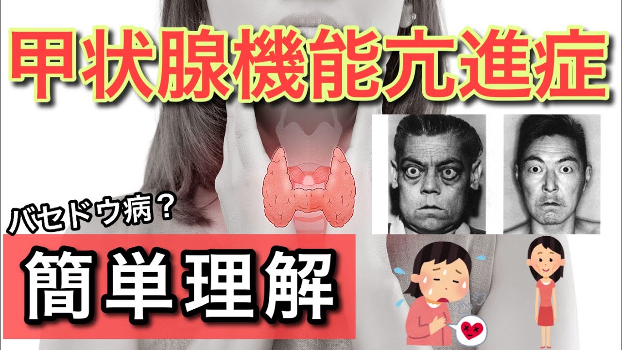 甲状腺機能亢進症の症状を調べてください