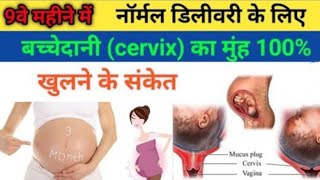 बच्चेदानी के मुँह खुलने के लक्षण | 5 Sign About Delivery | Delivery Symptoms | New Mom Dad