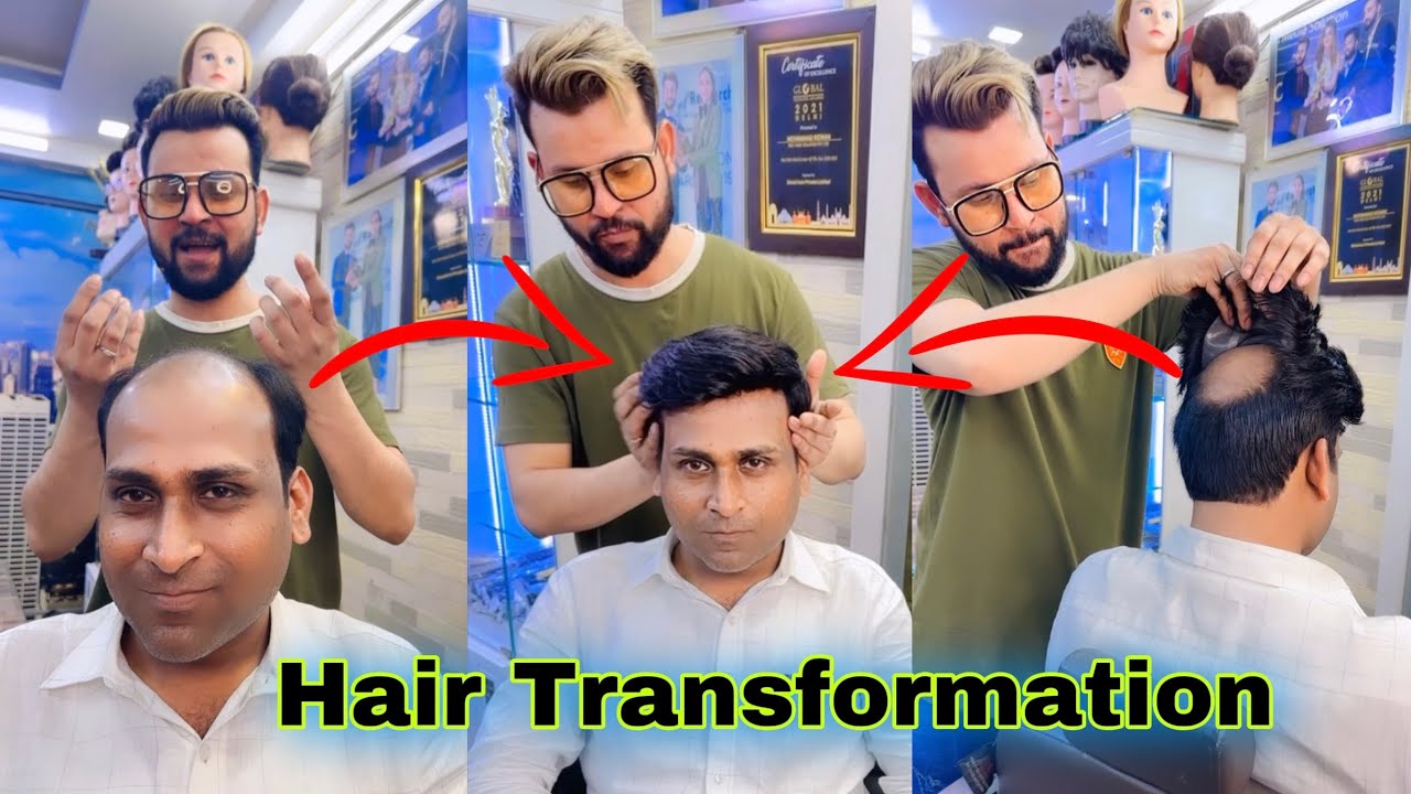 Hair Patch Live Work With RIZY | Hair Transformation | 9599858612 | -  YouTube