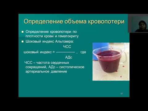 ГЕМОРРАГГИЧЕСКИЙ ШОК РУССКАЯ