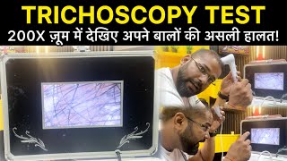 TriChoscopy Test After 52 Days of Hair Transplant | Kya new baal aaye hair Transplant ke baad?