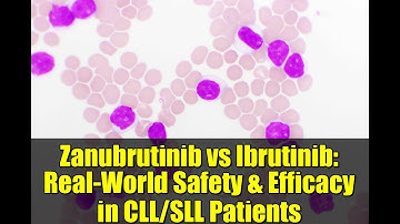 Zanubrutinib vs Ibrutinib: Real-World Safety & Efficacy in CLL/SLL Patients