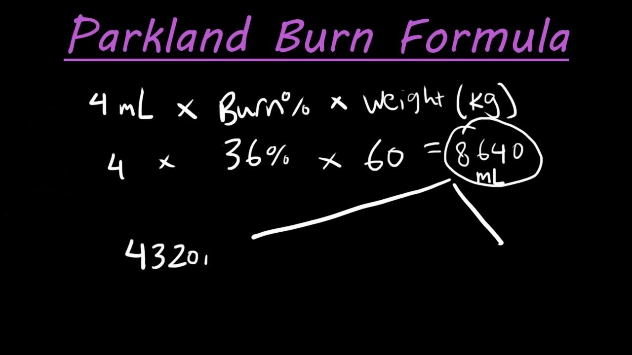 How to calculate the amount of fluids needed with the Parkland burn
