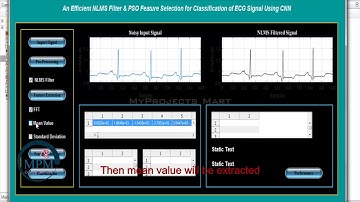 An Efficienct NLMS and PSO Feature Selection For Classification of ECG Signal Using CNN | MATLAB