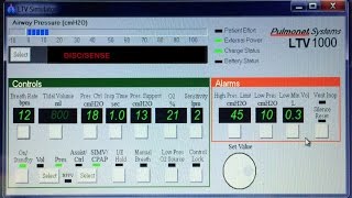 SIMV VENTILATOR MODE EXPLAINED