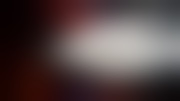 Uniportal VATS Resection of the Anterior Segment of the Left Upper Lobe