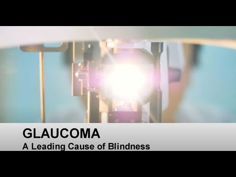 GLAUCOMA is a LEADING CAUSE OF BLINDNESS!