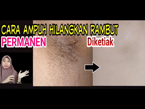 Video: Metode Alternatif Untuk Menghilangkan Rambut