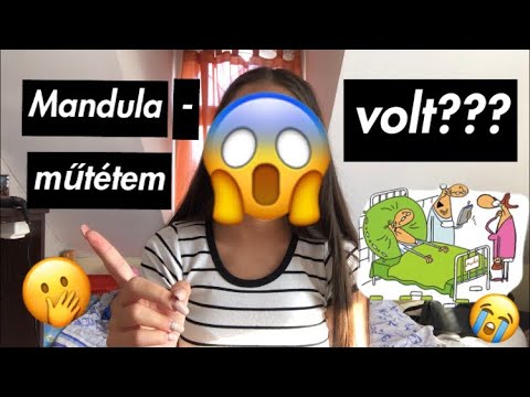 Videó: Hogyan Aprítsuk Fel A Mandulát