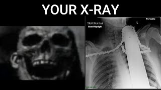 Mr Incredible Becoming Uncanny (Your X - RAY)!!!